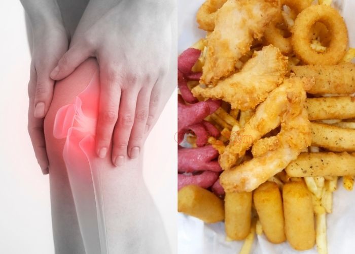 Thực phẩm chế biến sẵn có thể khiến đau nhức xương khớp