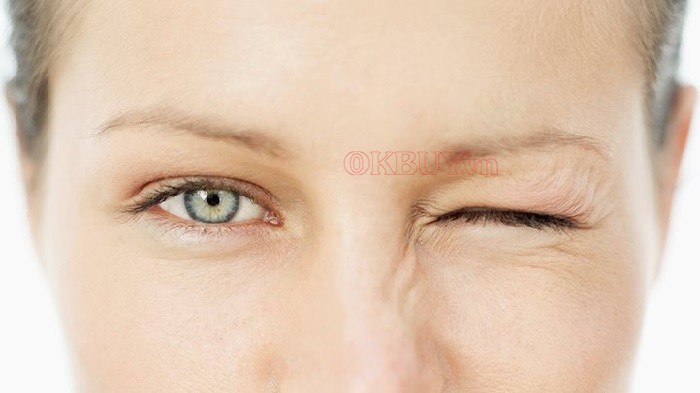 Nháy mắt trái liên tục là do mỏi mắt, căng thẳng và kích ứng mắt gây ra