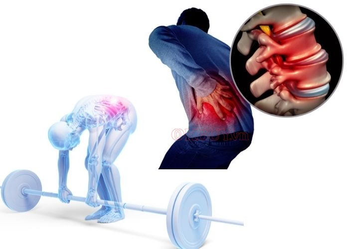 Tập luyện với tư thế sai cũng có thể gây đau nhức vùng lưng trầm trọng