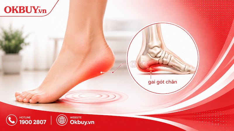 Gai gót chân gây đau nhức lòng bàn chân khi đứng và di chuyển