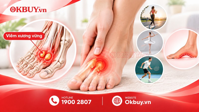 Viêm xương vừng có thể gây đau tại vùng gốc ngón chân cái và lòng bàn chân.