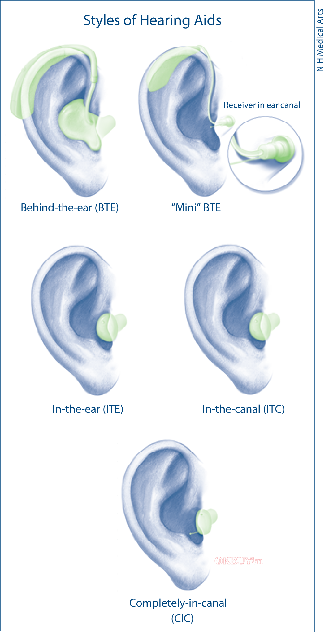 Các kiểu máy trợ thính BTE, mini BTE, ITE, ITC và CIC