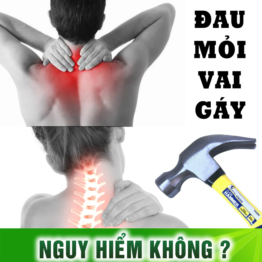 Đau cổ mỏi vai gáy nên làm gì cho nhanh khỏi?