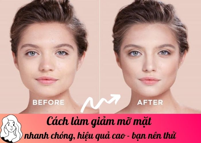 Cách làm giảm mỡ mặt nhanh chóng, hiệu quả cao - bạn nên thử