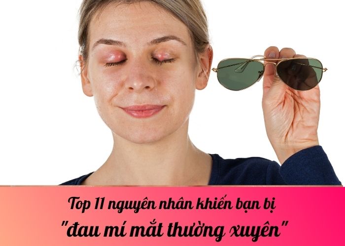 Top 11 nguyên nhân khiến bạn bị đau mí mắt thường xuyên?