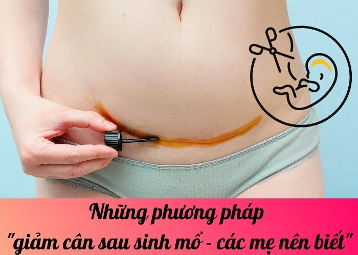 Những phương pháp giảm cân sau sinh mổ - các mẹ nên biết