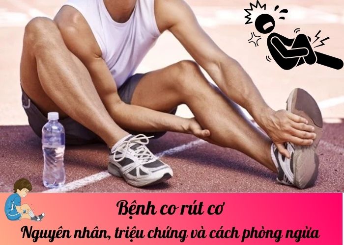 Bệnh co rút cơ: Nguyên nhân, triệu chứng và cách phòng ngừa 