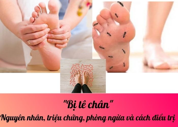 Bị tê chân: Nguyên nhân, triệu chứng, phòng ngừa và cách điều trị