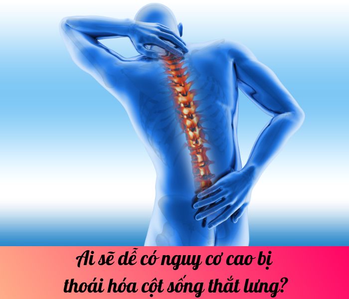 Ai sẽ dễ có nguy cơ cao bị thoái hóa cột sống thắt lưng?