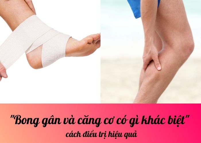 Bong gân và căng cơ có gì khác biệt – cách điều trị hiệu quả