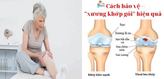 Cách bảo vệ xương khớp gối hiệu quả