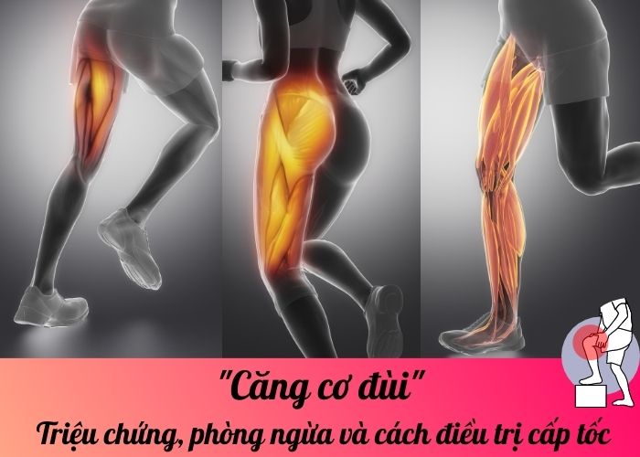 Căng cơ đùi: Triệu chứng, phòng ngừa và cách điều trị cấp tốc