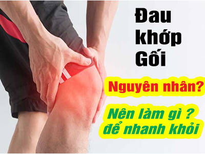 Nên làm gì khi bị đau đầu gối mỗi khi co chân?