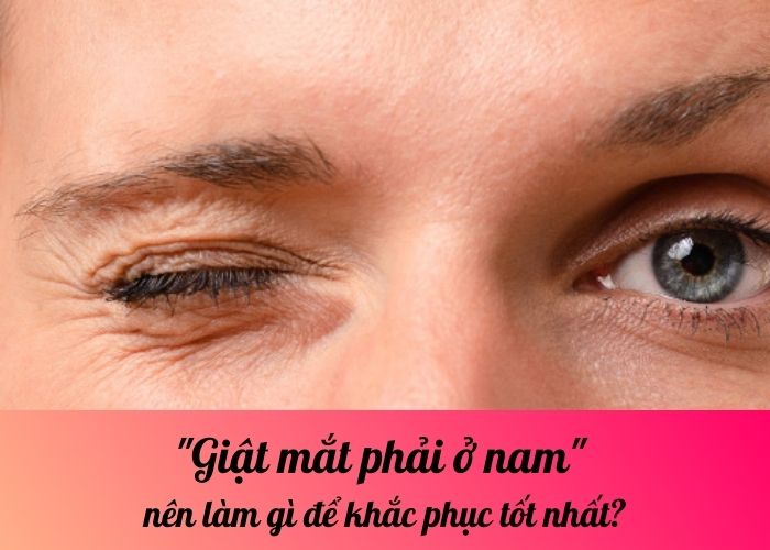 Giật mắt phải ở nam nên làm gì để khắc phục tốt nhất?