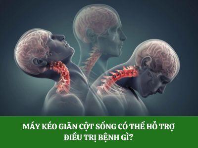 Máy kéo giãn cột sống có thể hỗ trợ điều trị bệnh gì?