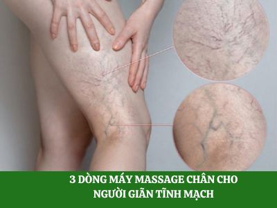 Danh sách 3 máy massage chân cho người giãn tĩnh mạch hàng đầu