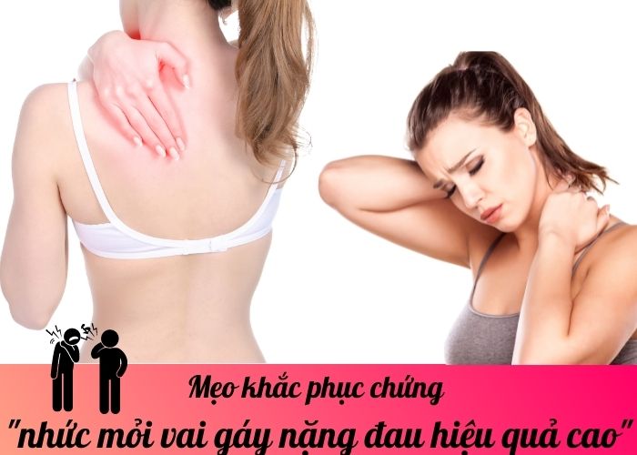 Mẹo khắc phục chứng nhức mỏi vai gáy nặng đau hiệu quả cao