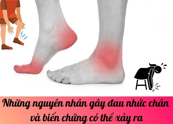 Những nguyên nhân gây đau nhức chân và biến chứng có thể xảy ra