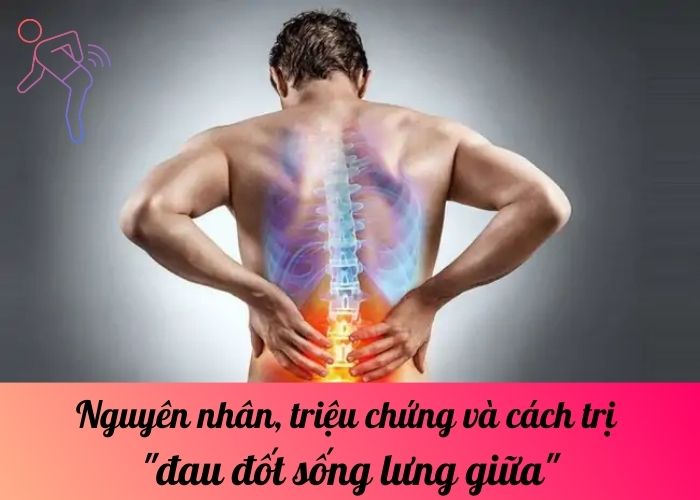 Nguyên nhân, triệu chứng và cách trị đau đốt sống lưng giữa