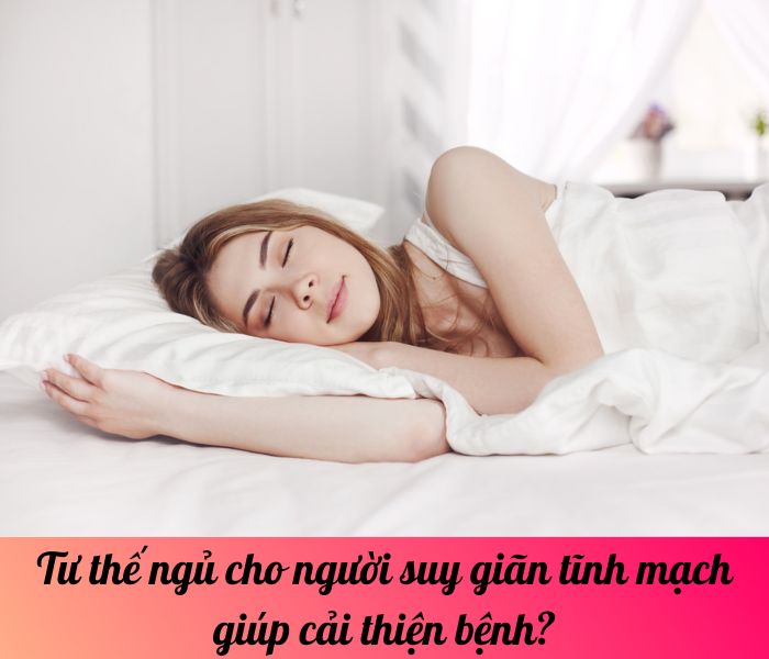 Tư thế ngủ cho người suy giãn tĩnh mạch giúp cải thiện bệnh?