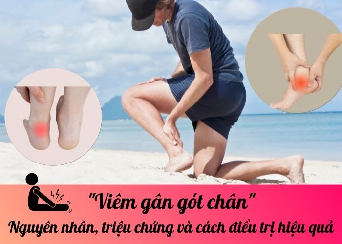 Viêm gân gót chân: Nguyên nhân, triệu chứng và cách điều trị hiệu quả