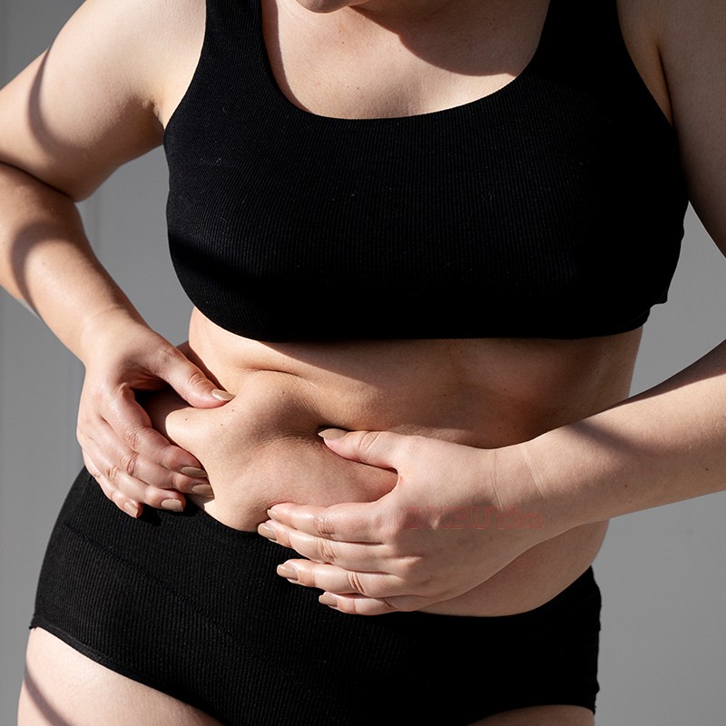 Vì sao mỡ bụng lại đeo bám dai dẳng