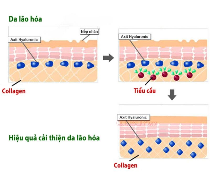 Collagen và elastin là hai tác nhân hình thành nên chảy xệ của làn da